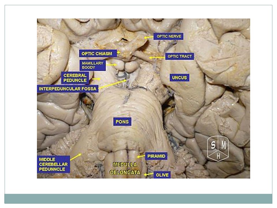 Pons. Pons The base of the pons (basis pontis) contains three components:  fiber bundles of the corticospinal tracts, pontine nuclei. - ppt video  online download