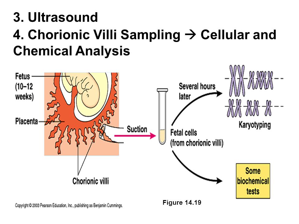 3. Ultrasound 4. Chorionic Villi Sampling  Cellular and Chemical Analysis Figure 14.19