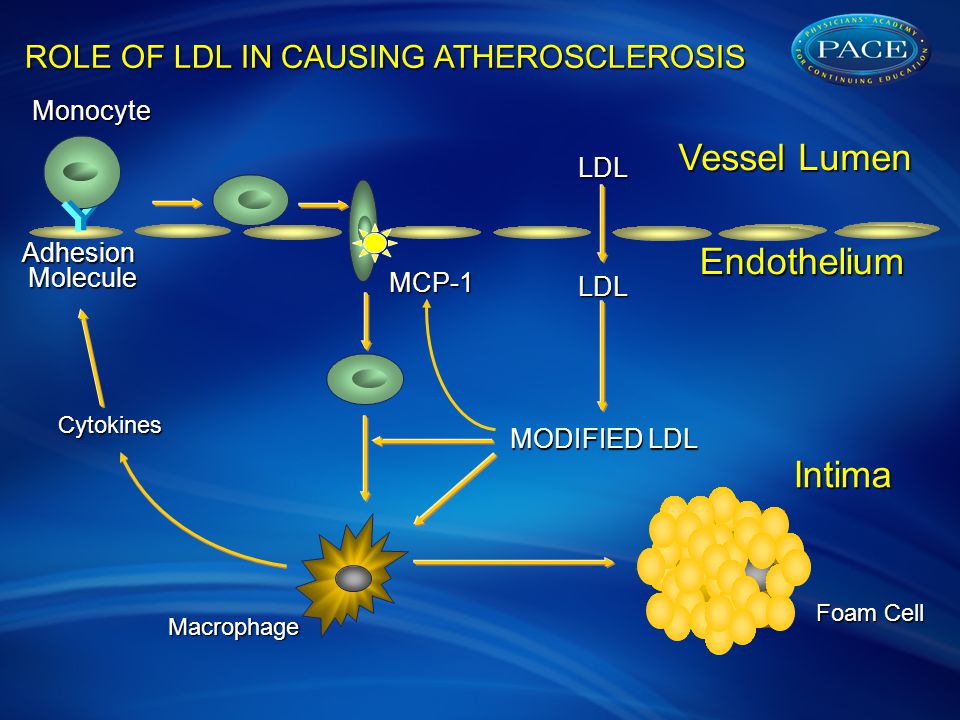 Adhesion Molecule Molecule Monocyte Intima Vessel Lumen Endothelium LDL LDL MCP-1 Macrophage Cytokines Foam Cell MODIFIED LDL ROLE OF LDL IN CAUSING ATHEROSCLEROSIS