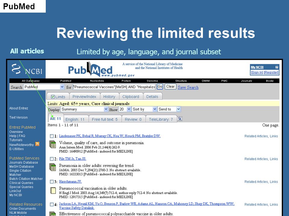 Reviewing the limited results Limited by age, language, and journal subset All articles PubMed