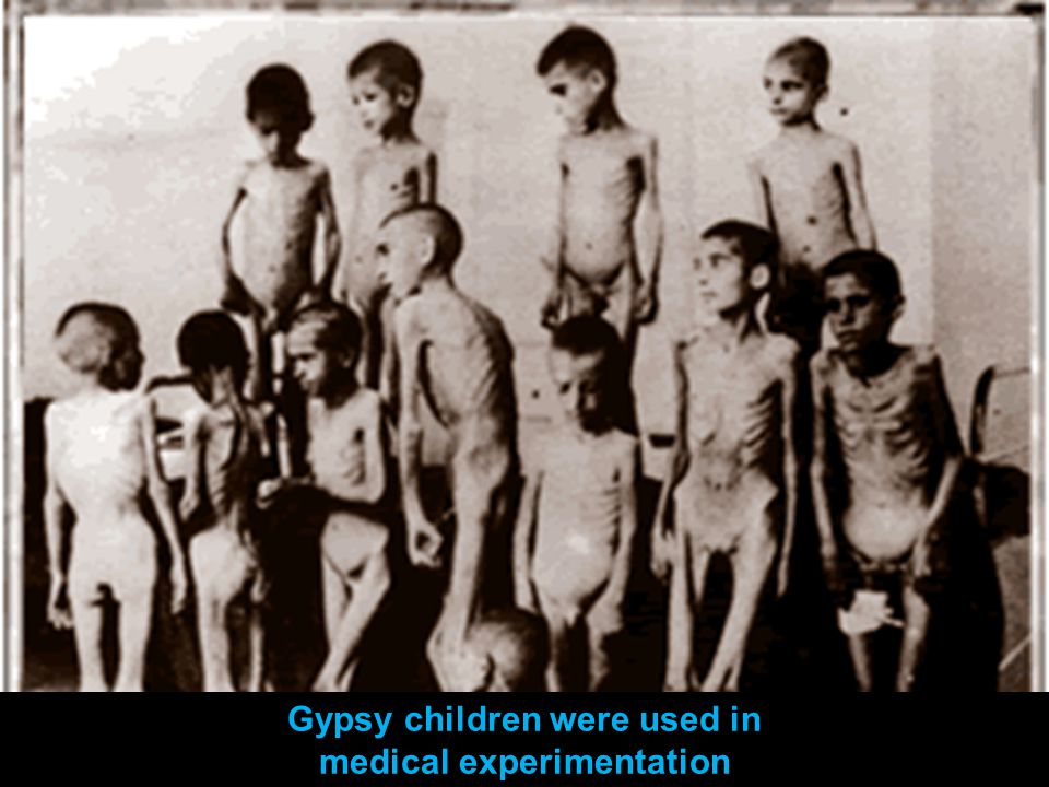 Gypsy children were used in medical experimentation