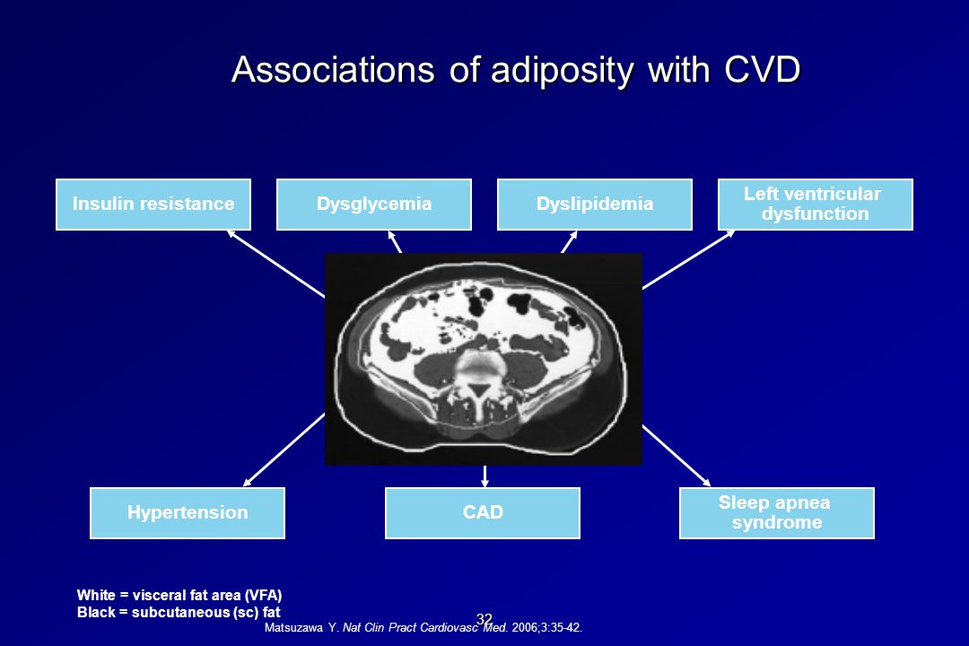 32 Associations of adiposity with CVD Matsuzawa Y.
