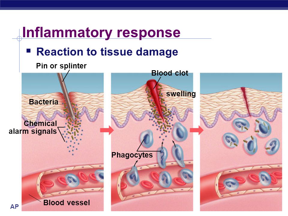 AP Biology Inflammatory response  Damage to tissue triggers local non-specific inflammatory response  release histamines & prostaglandins  capillaries dilate, more permeable (leaky)  increase blood supply  delivers WBC, RBC, platelets, clotting factors  fight pathogens  clot formation  accounts for swelling, redness & heat of inflammation & infection