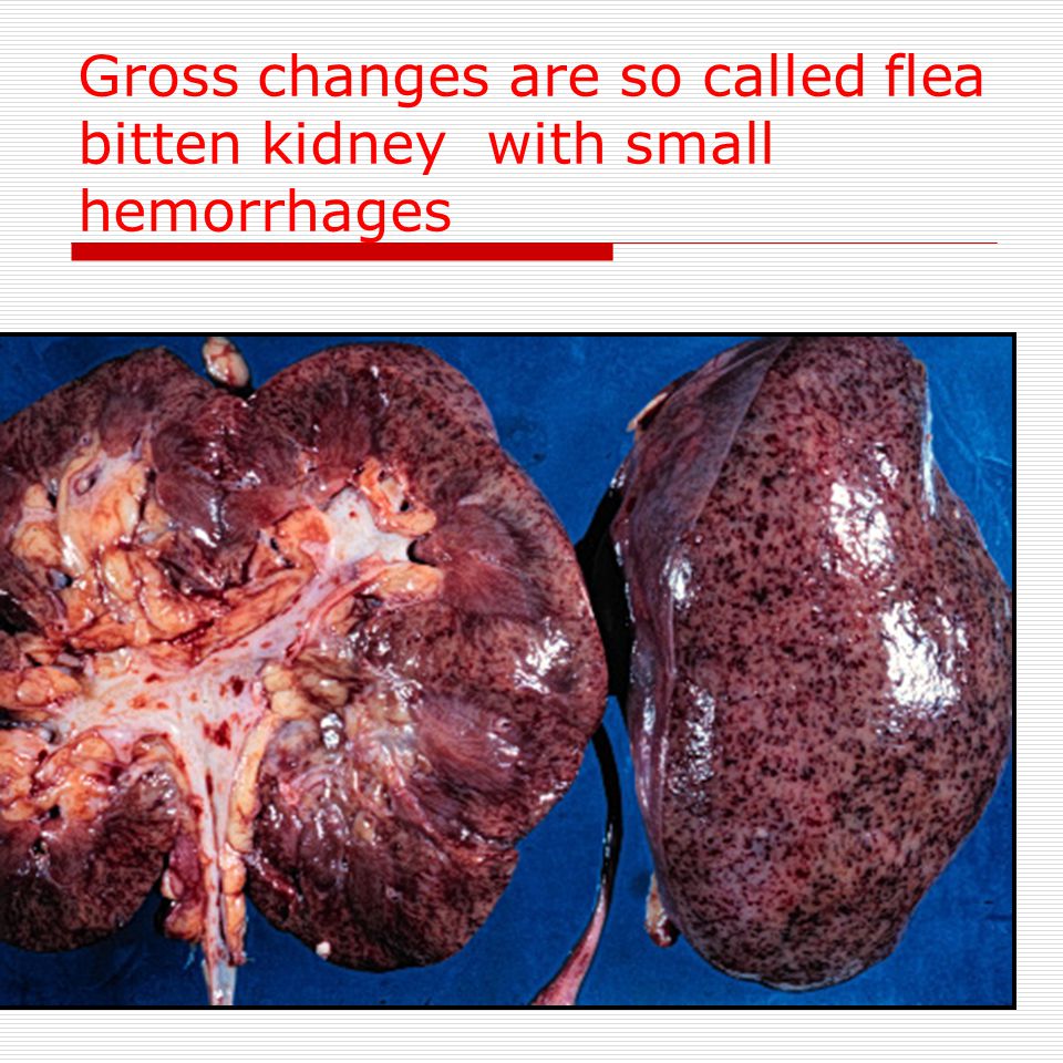 PATHOLOGY Chronic Renal Failure Objectives \uf06f Recognize the clinical  pathological correlation of biological progression and gross and  microscopic. - ppt download