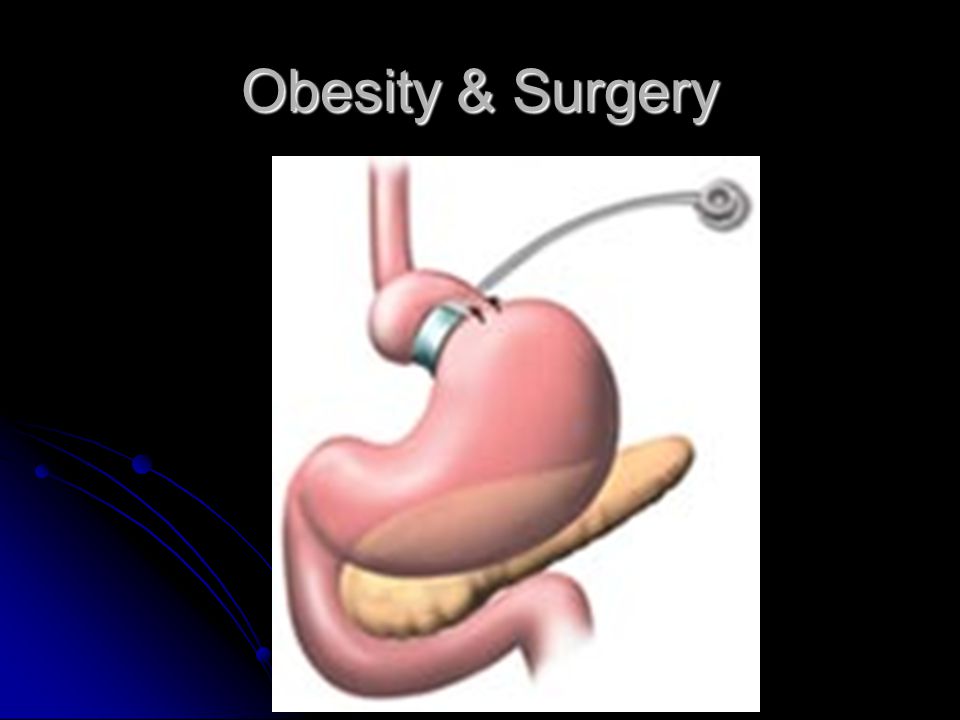 Obesity & Surgery LAP-BAND System