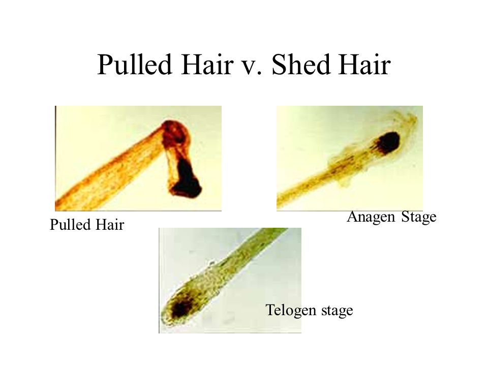 The Wonderful World of Hairs and Fibers. Different Scopes used to analyze  hair and fiber Compound light Comparison Dissecting Polarized Scanning  Electron. - ppt download