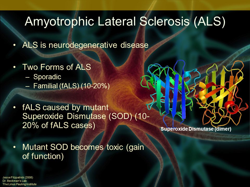 Amyotrophic Lateral Sclerosis (ALS) ALS is neurodegenerative disease Two Forms of ALS –Sporadic –Familial (fALS) (10-20%) fALS caused by mutant Superoxide Dismutase (SOD) (10- 20% of fALS cases) Mutant SOD becomes toxic (gain of function) Jesse Fitzpatrick (2008) Dr.