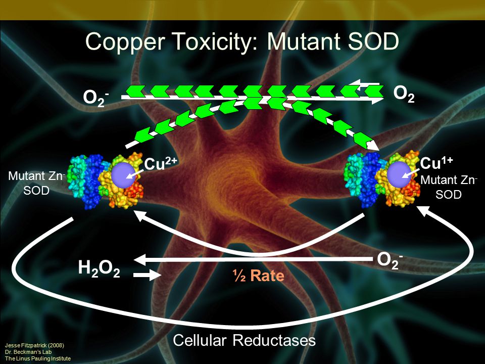 Copper Toxicity: Mutant SOD Jesse Fitzpatrick (2008) Dr.
