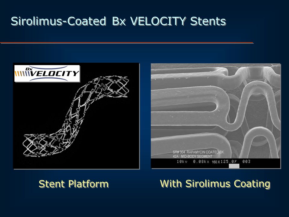 Sirolimus-Coated Bx VELOCITY Stents With Sirolimus Coating Stent Platform