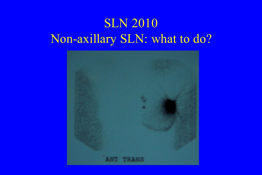 SLN 2010 Non-axillary SLN: what to do