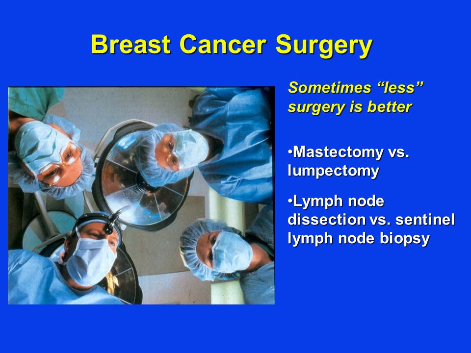Breast Cancer Surgery Sometimes less surgery is better Mastectomy vs.