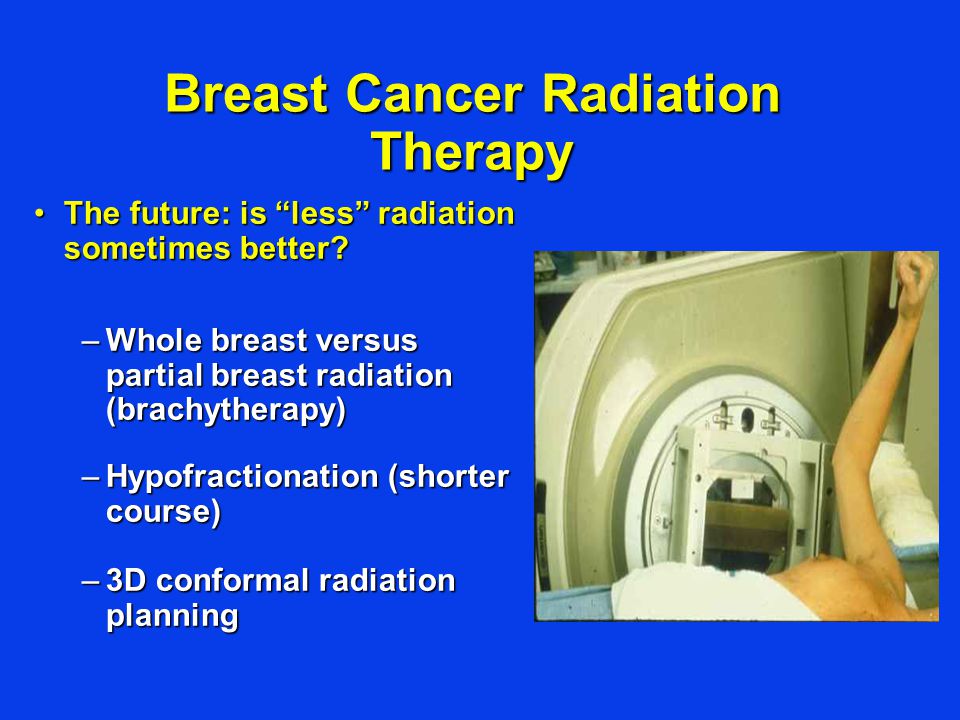 Breast Cancer Radiation Therapy The future: is less radiation sometimes better The future: is less radiation sometimes better.