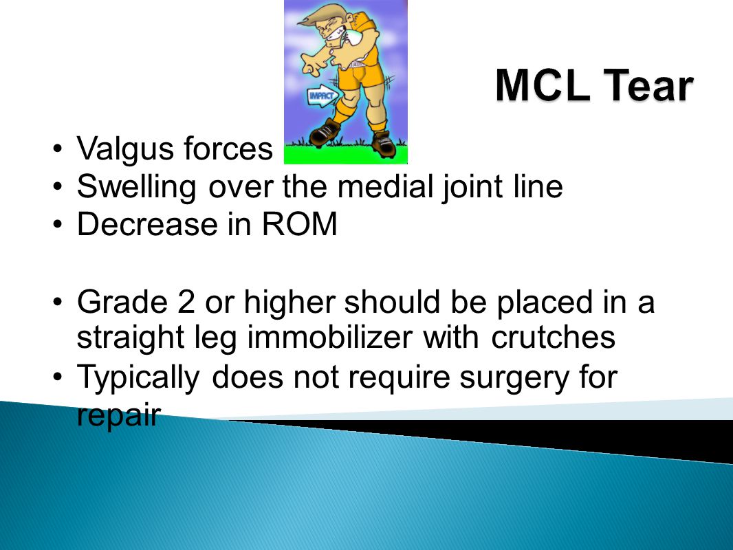 Valgus forces Swelling over the medial joint line Decrease in ROM Grade 2 or higher should be placed in a straight leg immobilizer with crutches Typically does not require surgery for repair