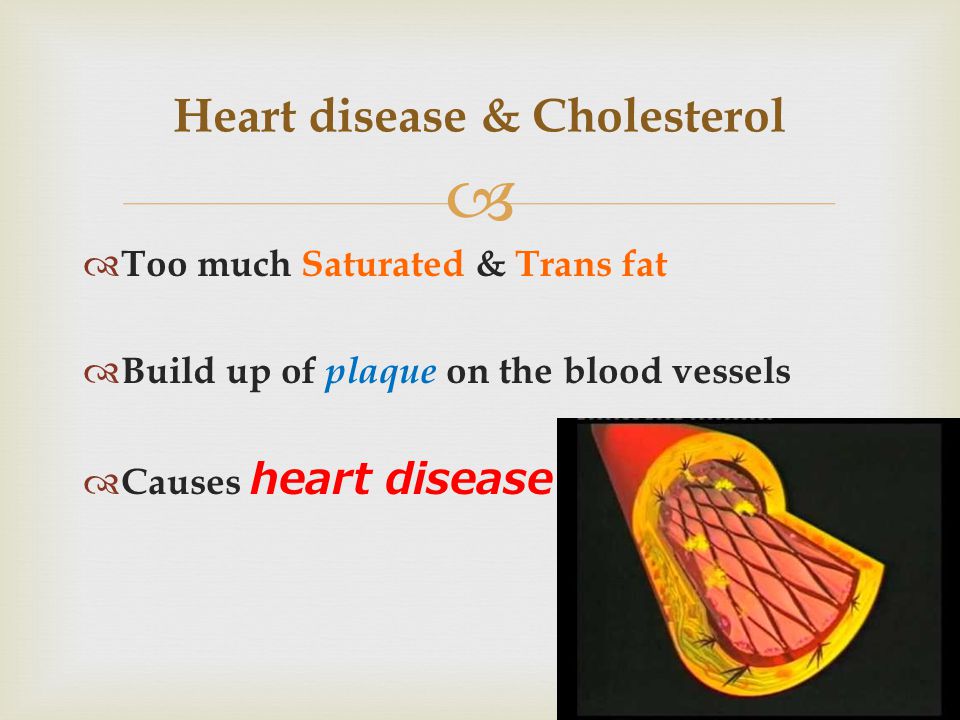   Too much Saturated & Trans fat  Build up of plaque on the blood vessels  Causes heart disease Heart disease & Cholesterol