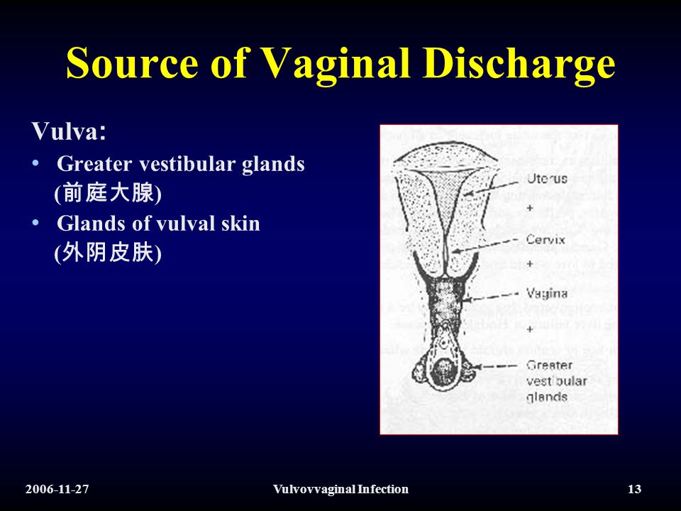 Nufiya SG - Vaginal discharge is a fluid released by glands in the
