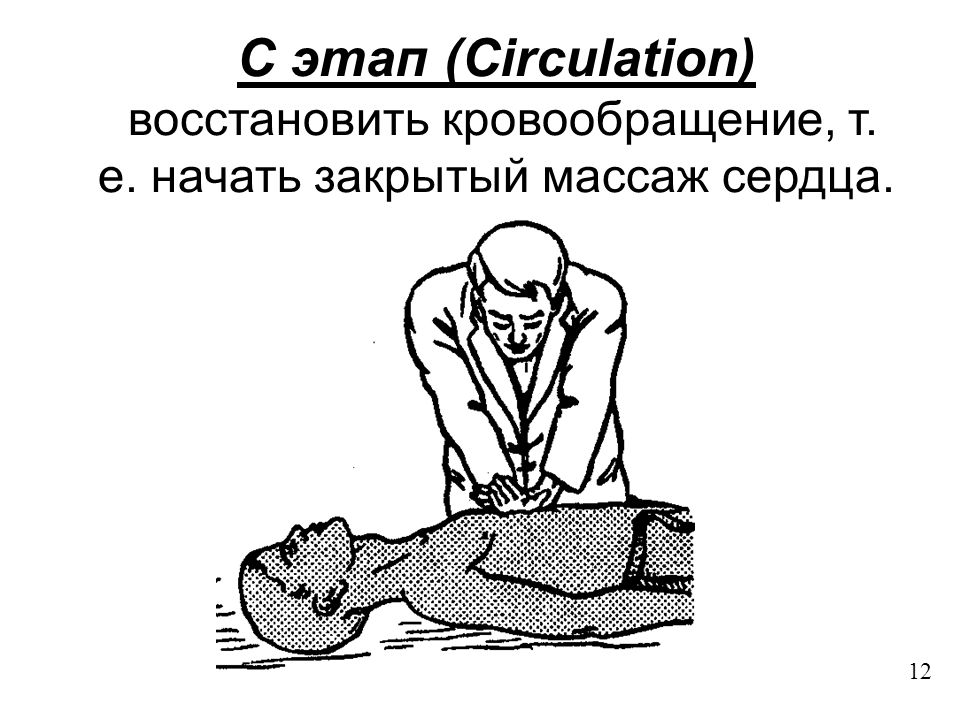 Закрытый массаж. Восстановление кровообращения. СЛР закрытый массаж сердца. СЛР анестезиология и реаниматология. Этапы СЛР кровообращения.