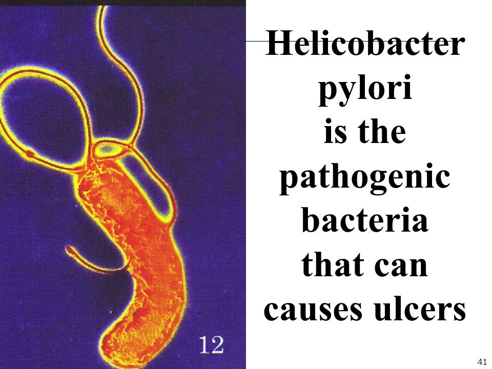 41 Helicobacter pylori is the pathogenic bacteria that can causes ulcers