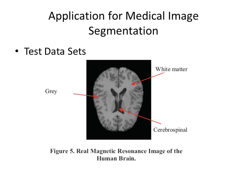 Application for Medical Image Segmentation Test Data Sets