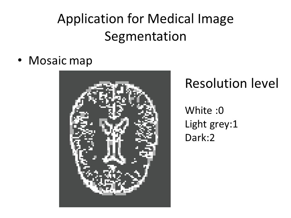 Application for Medical Image Segmentation Mosaic map Resolution level White :0 Light grey:1 Dark:2