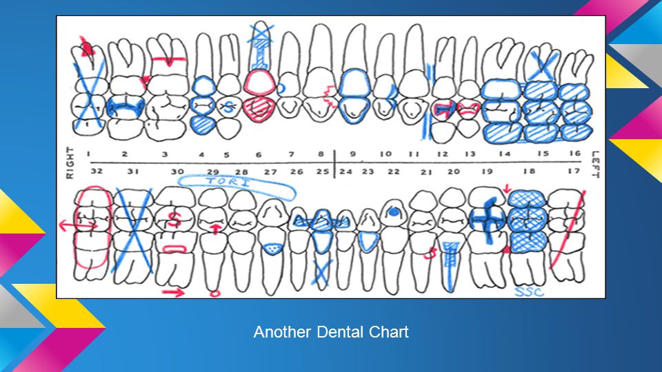 Dental Charting Practice