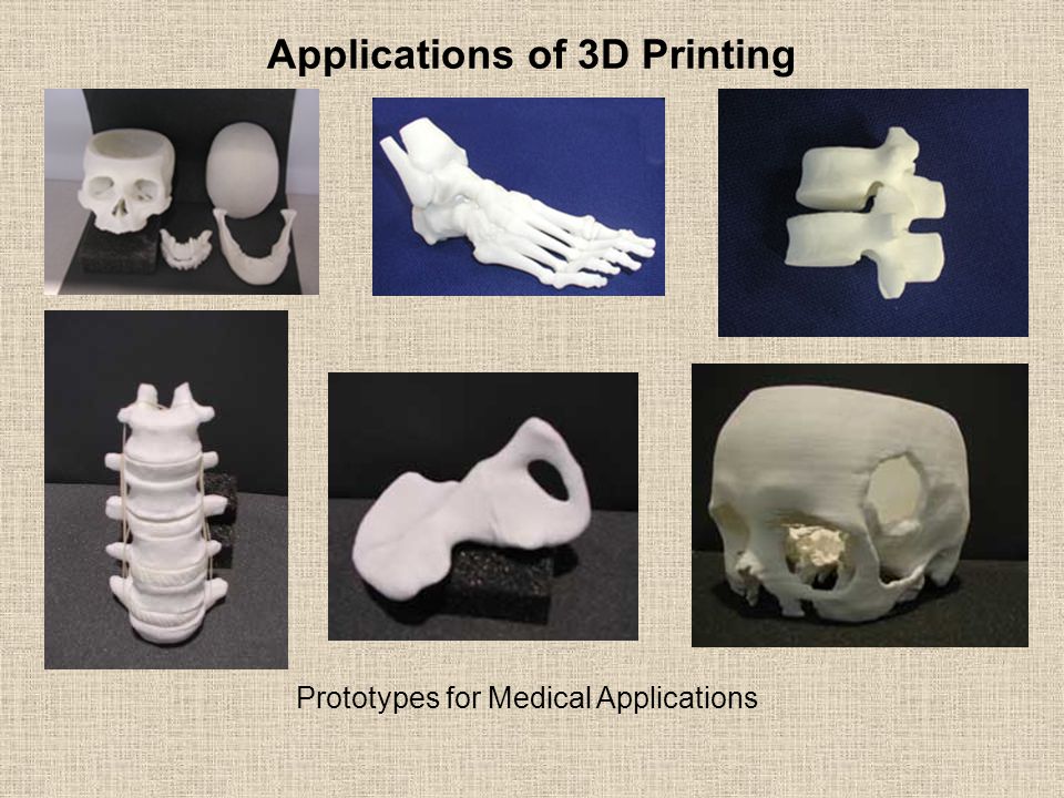 Applications of 3D Printing Prototypes for Medical Applications