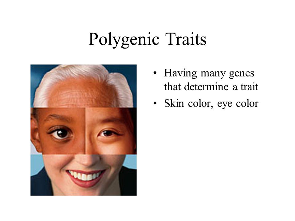 Polygenic Traits Having many genes that determine a trait Skin color, eye color