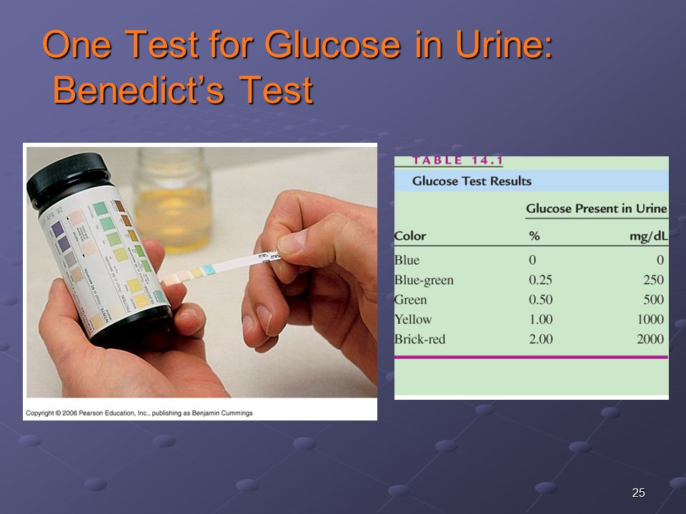 25 One Test for Glucose in Urine: Benedict’s Test