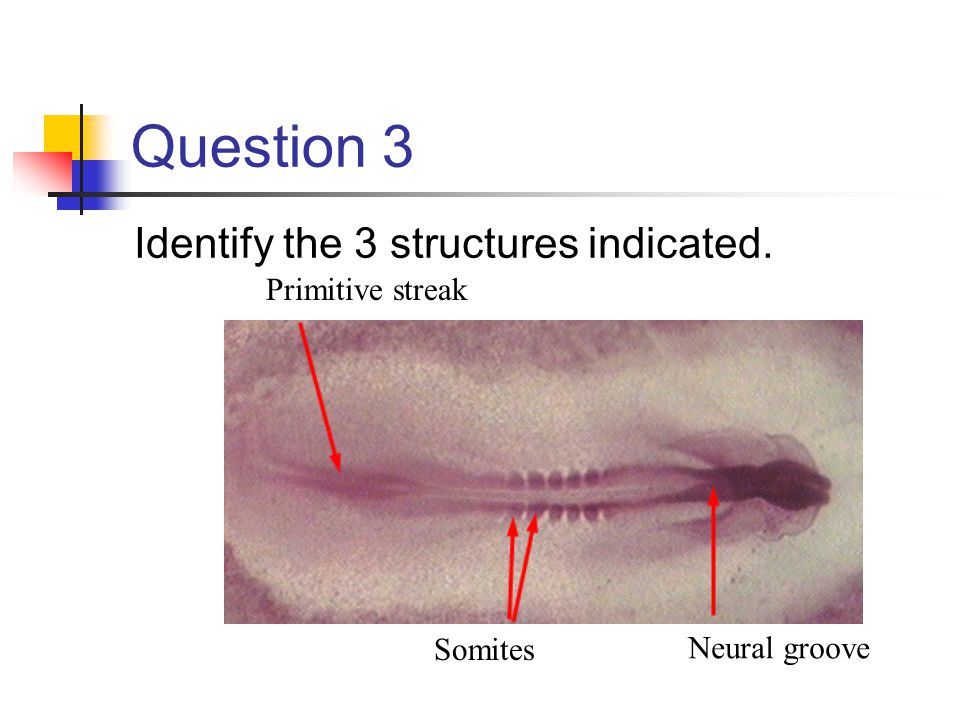 Question 3 Identify the 3 structures indicated. Primitive streak Somites Neural groove
