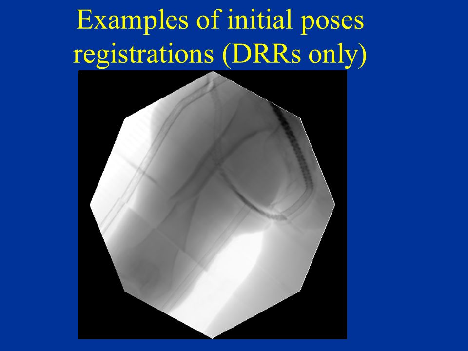 Examples of initial poses registrations (DRRs only)