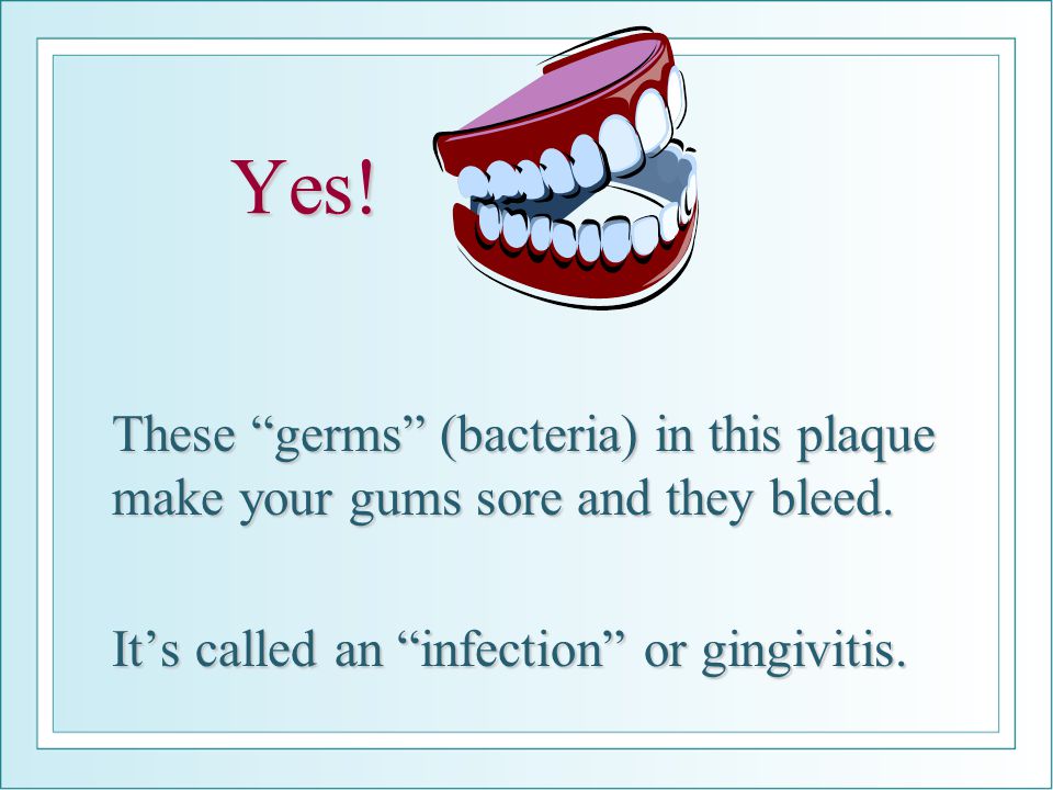 Yes. These germs (bacteria) in this plaque make your gums sore and they bleed.