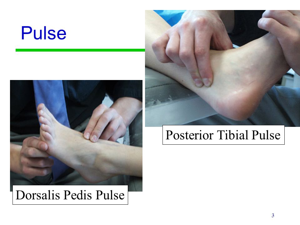 dorsalis pedis pulse