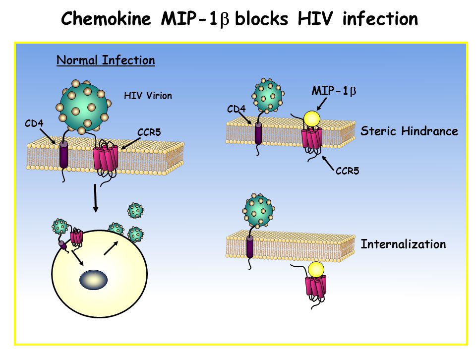 Chemokine MIP-1  blocks HIV infection CD4 CCR5 Normal Infection HIV Virion CD4 CCR5 MIP-1  Steric Hindrance Internalization