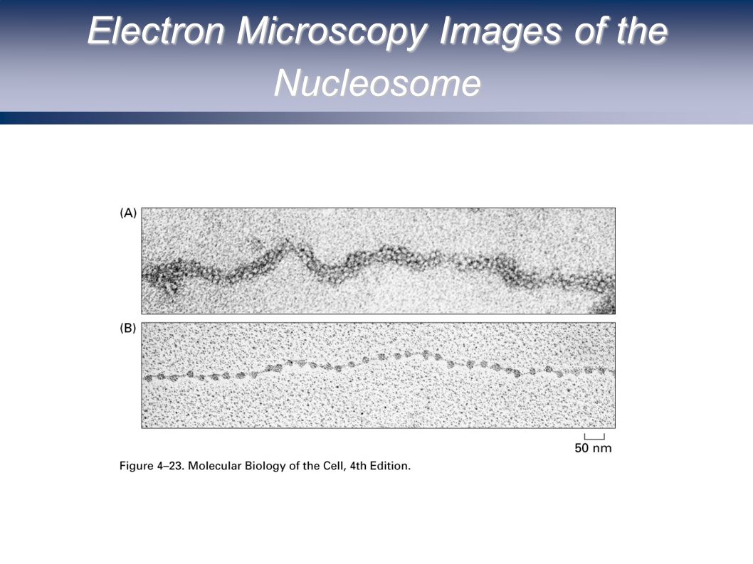 Electron Microscopy Images of the Nucleosome