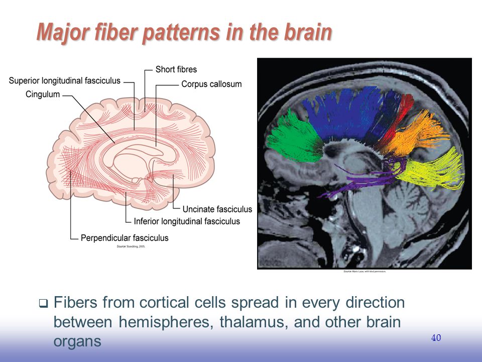 EE Major fiber patterns in the brain  Fibers from cortical cells spread in every direction between hemispheres, thalamus, and other brain organs