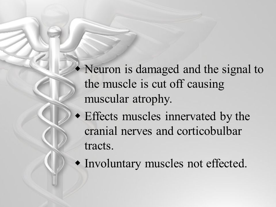  Neuron is damaged and the signal to the muscle is cut off causing muscular atrophy.