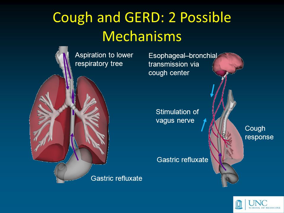 ... Esophageal-bronchial transmission via cough center Aspiration to lower respiratory tree Gastric refluxate Cough and GERD: 2 Possible Mechanisms