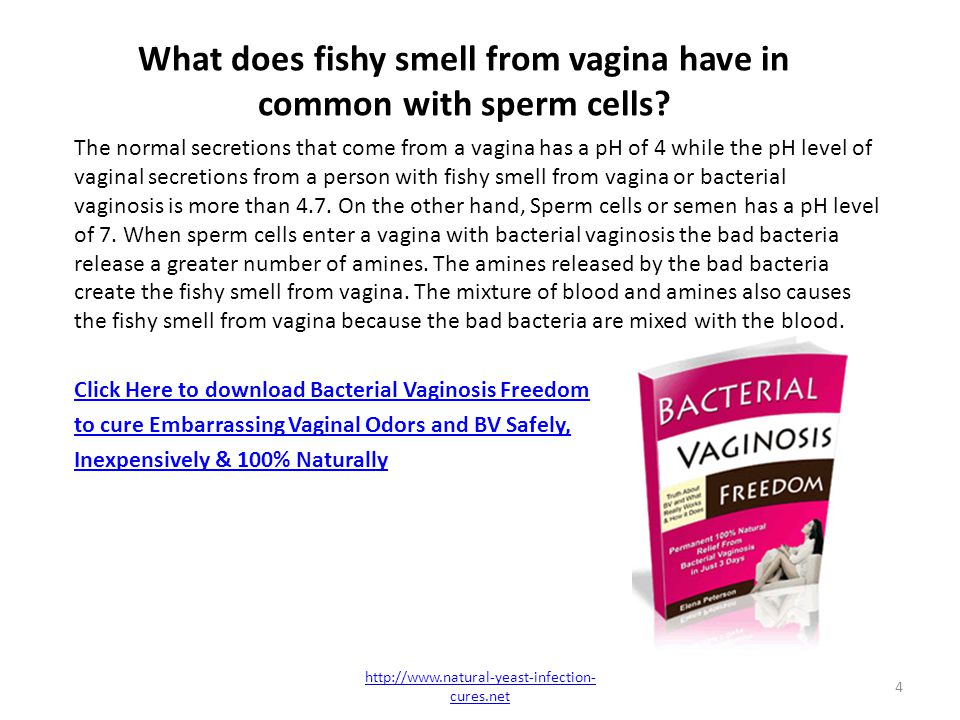Smell why does fishy sperm Which STD