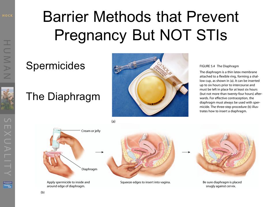 Barrier Methods that Prevent Pregnancy But NOT STIs Spermicides The Diaphra...