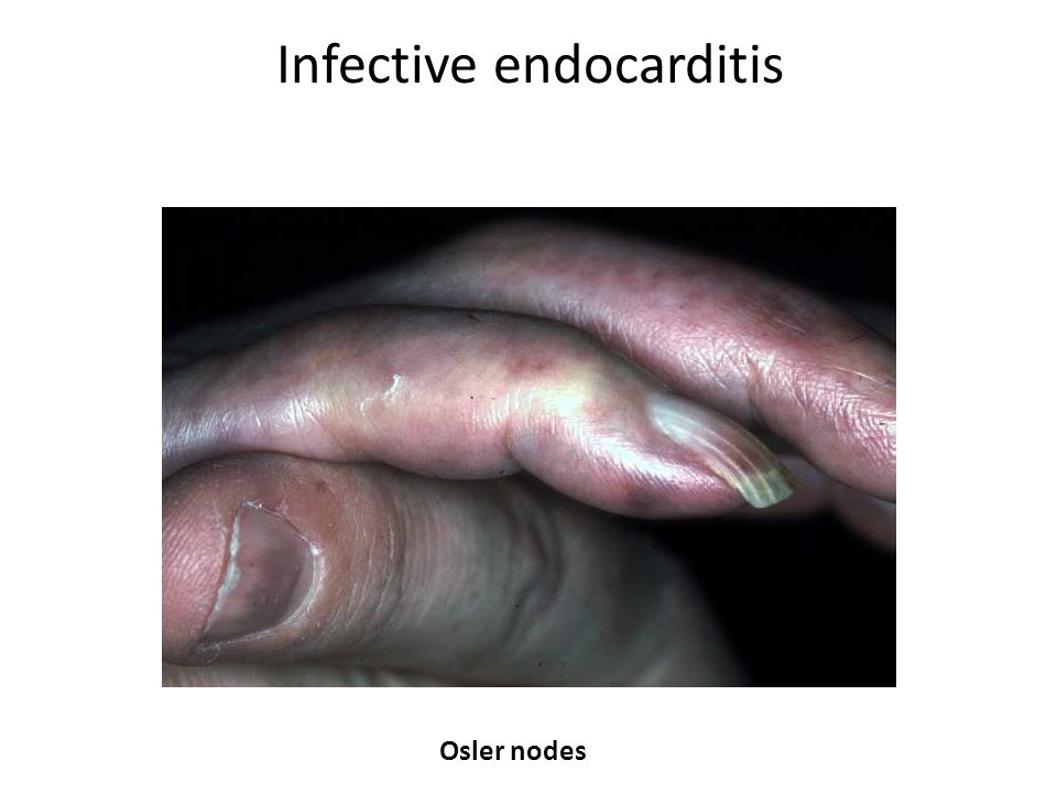 cutaneous manifestation of cardiovascular disease done by mohammad