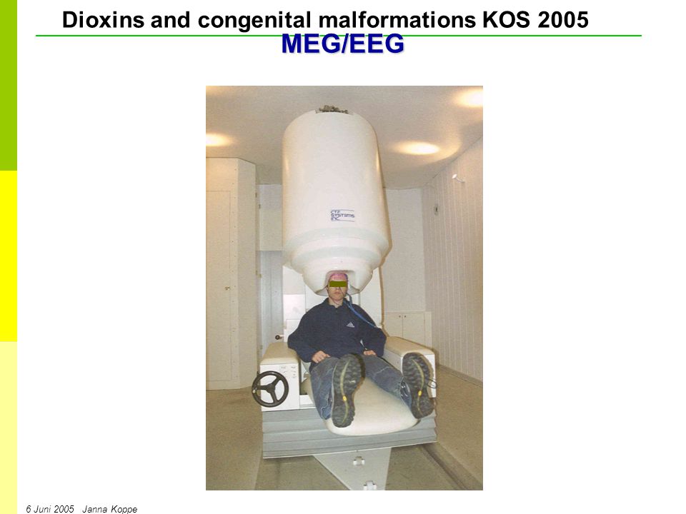 Dioxins and congenital malformations KOS Juni 2005 Janna KoppeMEG/EEG