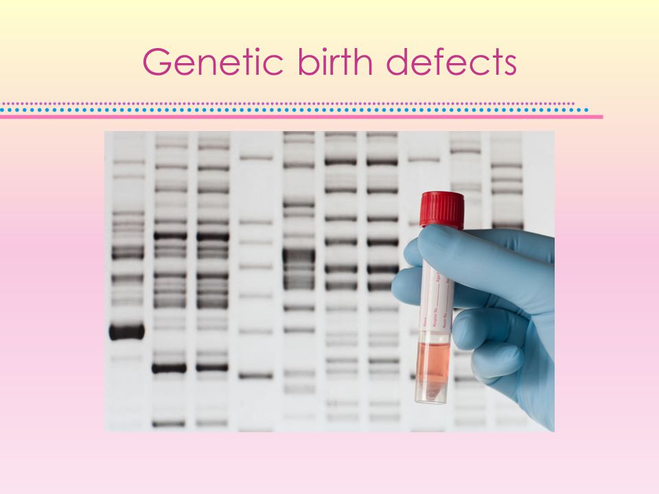 Genetic birth defects