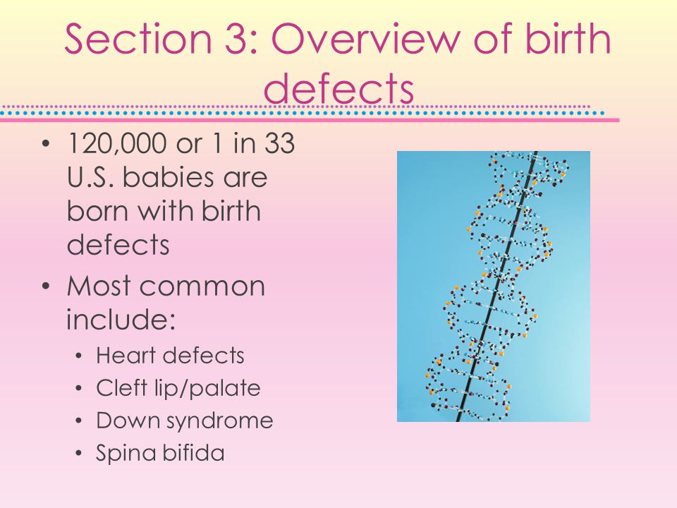 Section 3: Overview of birth defects 120,000 or 1 in 33 U.S.