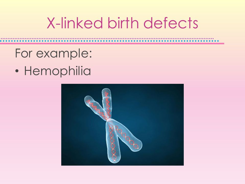 X-linked birth defects For example: Hemophilia