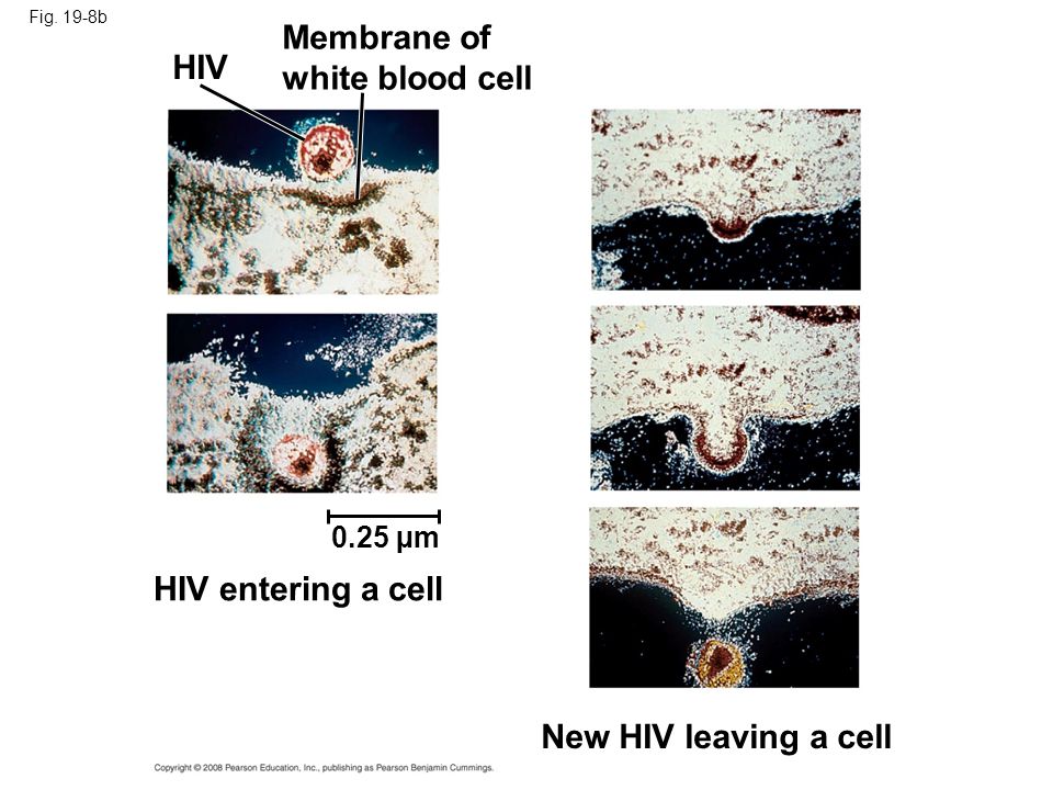 Fig. 19-8b HIV Membrane of white blood cell HIV entering a cell 0.25 µm New HIV leaving a cell