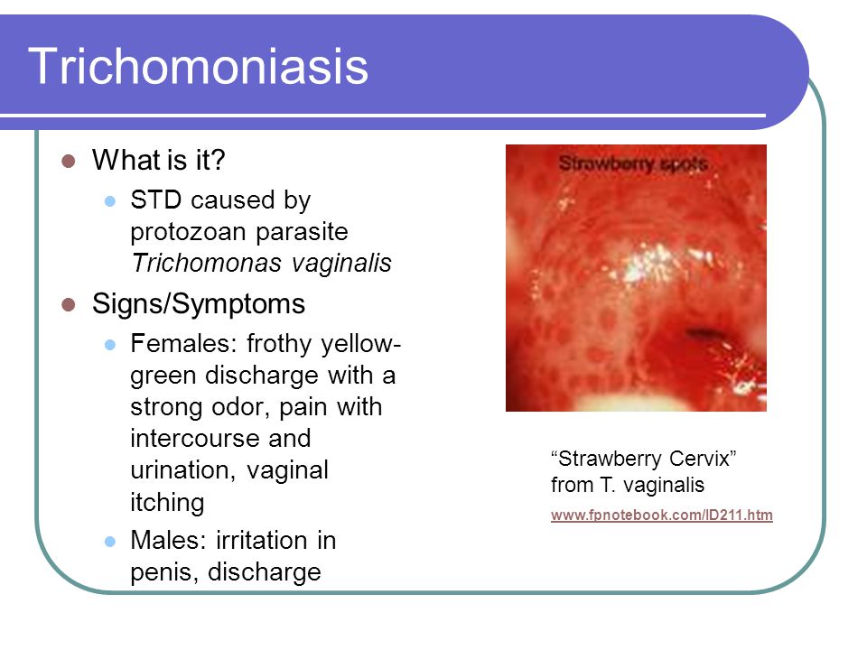 trichomoniasis pénisz