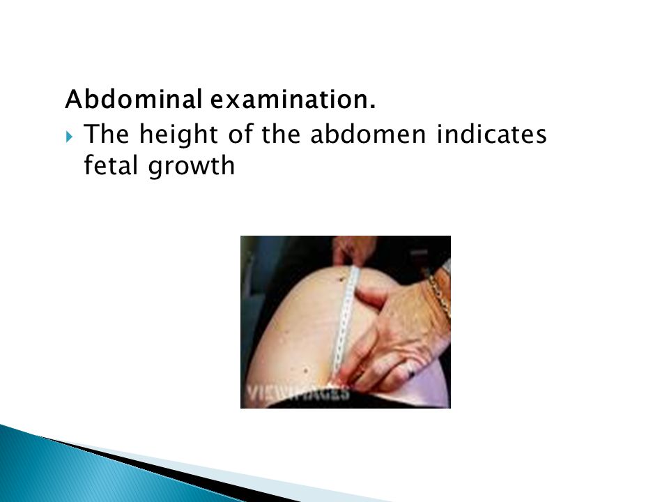 Abdominal examination.  The height of the abdomen indicates fetal growth