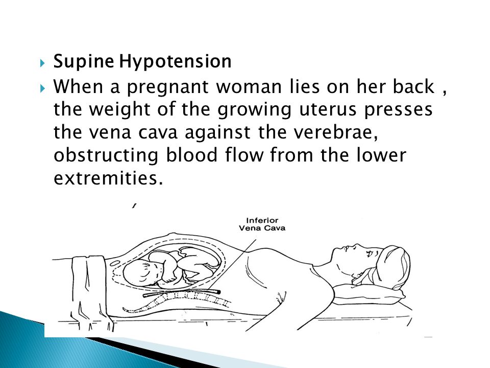  Supine Hypotension  When a pregnant woman lies on her back, the weight of the growing uterus presses the vena cava against the verebrae, obstructing blood flow from the lower extremities.