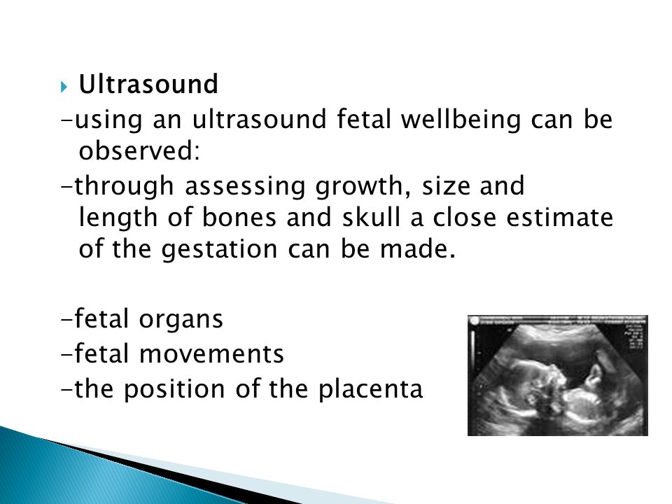  Ultrasound -using an ultrasound fetal wellbeing can be observed: -through assessing growth, size and length of bones and skull a close estimate of the gestation can be made.