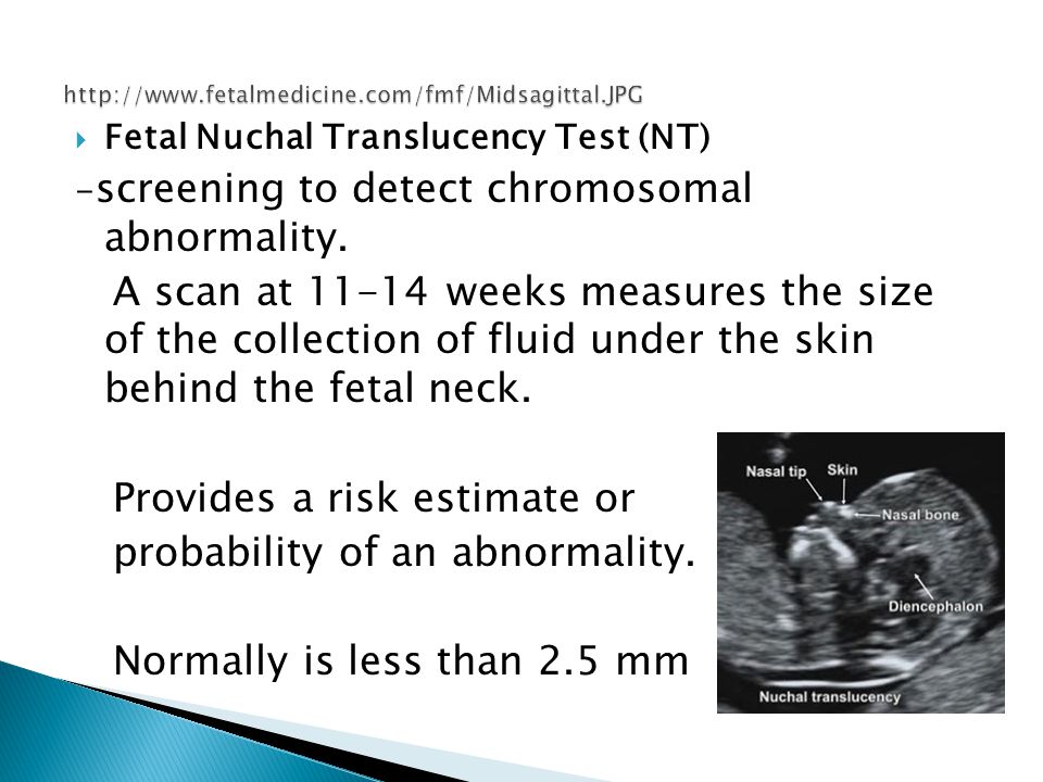  Fetal Nuchal Translucency Test (NT) - screening to detect chromosomal abnormality.