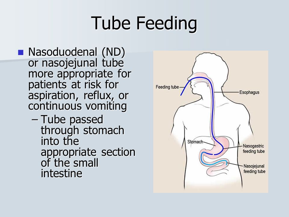 More appropriate. Презентация the Human body. Nasogastric tube. Normal Flora.